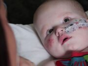 والدة الطفل مع ضمور عضلي العمود الفقري تريد أن يتم اختبار جميع الأطفال حديثي الولادة لذلك | أخبار المملكة المتحدة