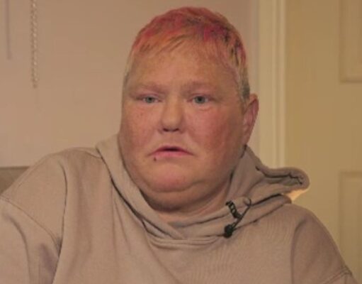 يجب على الأشخاص الذين يعانون من صعوبات التعلم أن “يتحدثوا” عن المخاوف الصحية، كما تقول امرأة مصابة بتشخيص متأخر لمرض السرطان | أخبار المملكة المتحدة